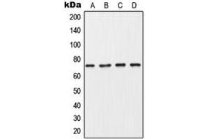 Western blot analysis of Collagen 8 alpha 1 expression in MDA-MB453 (A), A549 (B), SP2/0 (C), PC12 (D) whole cell lysates. (COL8A1 antibody  (Center))