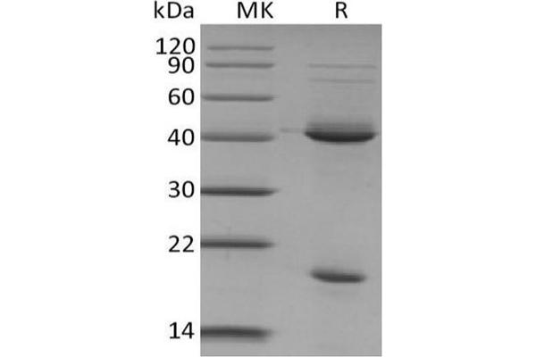 IL23 Protein