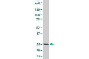 RPIA MaxPab polyclonal antibody. (Ribose 5-Phosphate Isomerase A (RPIA) (AA 1-237) antibody)