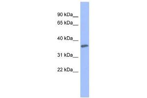 PRKCG antibody used at 1 ug/ml to detect target protein. (PKC gamma antibody  (Middle Region))