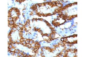 IHC testing of FFPE mouse kidney tissue with recombinant Cadherin 16 antibody (clone KSCP2-2R). (Cadherin-16 antibody)