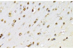Immunohistochemistry (Paraffin-embedded Sections) (IHC (p)) image for anti-Runt-Related Transcription Factor 1 (RUNX1) antibody (ABIN7260099)