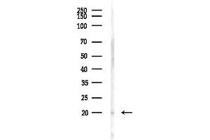 anti-Complexin 1 (CPLX1) (N-Term) antibody