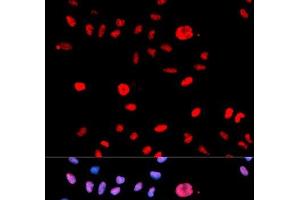 Immunofluorescence (IF) image for anti-Mdm2, p53 E3 Ubiquitin Protein Ligase Homolog (Mouse) (MDM2) (pSer166) antibody (ABIN7265062)