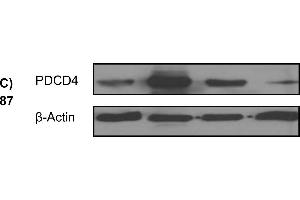 Western Blotting (WB) image for anti-Programmed Cell Death 4 (PDCD4) (pSer457) antibody (ABIN129708)
