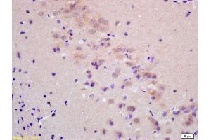 Formalin-fixed and paraffin embedded rat brain labeled with Rabbit Anti ChRM2 Polyclonal Antibody, Unconjugated (ABIN668646) at 1:200 followed by conjugation to the secondary antibody and DAB staining (Muscarinic Acetylcholine Receptor M2 antibody  (AA 168-250))