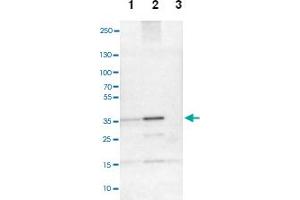 Western blot analysis of Lane 1: NIH-3T3 cell lysate (Mouse embryonic fibroblast cells), Lane 2: NBT-II cell lysate (Rat Wistar bladder tumour cells), Lane 3: PC12 cell lysate (Pheochromocytoma of rat adrenal medulla) with CREM polyclonal antibody.