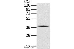Western blot analysis of A375 cell, using SPARC Polyclonal Antibody at dilution of 1:400