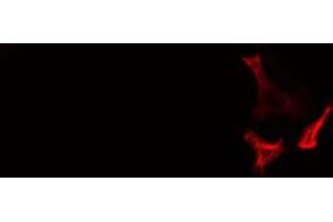 ABIN6278582 staining  LOVO cells by IF/ICC. (CABLES1 antibody  (C-Term))