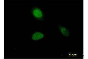 Immunofluorescence of purified MaxPab antibody to HIST1H1A on HeLa cell. (Histone H1.1 antibody  (AA 1-215))