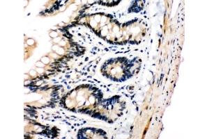 Immunohistochemistry (IHC) image for anti-Polo-Like Kinase 2 (PLK2) (C-Term) antibody (ABIN3032267)