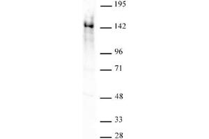 Ubn1 antibody (pAb) tested by Western blot. (Ubinuclein 1 antibody  (AA 1-345))