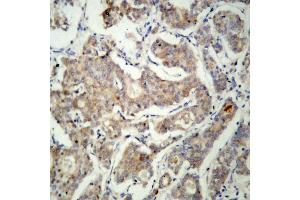 Image no. 2 for anti-BCL2-Associated Agonist of Cell Death (BAD) antibody (ABIN265323) (BAD antibody)