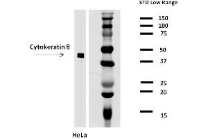Detection of cytokeratin 8 in HeLa cell lysate (reducing conditions) by mouse monoclonal antibody C-43. (KRT8 antibody)