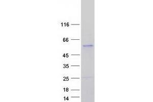 Validation with Western Blot (CSNK1G3 Protein (Transcript Variant 1) (Myc-DYKDDDDK Tag))