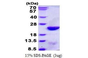Image no. 1 for Ubiquitin-Conjugating Enzyme E2C (UBE2C) protein (His tag) (ABIN1098371) (UBE2C Protein (His tag))