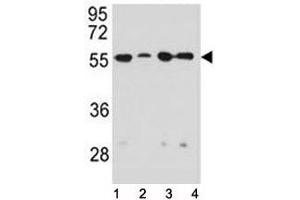 Vimentin antibody western blot analysis in 1) HeLa, 2) U251, 3) A549, and 4) MDA-MB231 lysate