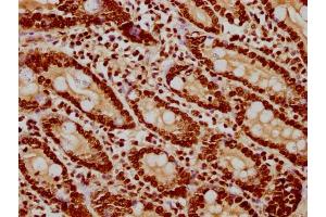 Immunohistochemistry (IHC) image for anti-Histone Cluster 1, H3a (HIST1H3A) (AA 120-132) antibody (ABIN7181543)