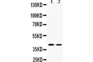 Western blot analysis of ATF4 expression in U2OS whole cell lysates ( Lane 1) and SW620 whole cell lysates ( Lane 2). (ATF4 antibody  (N-Term))