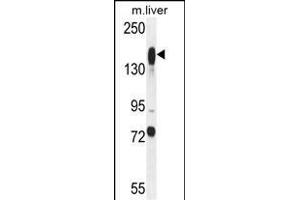 ASXL1 Antibody (Center) (ABIN655084 and ABIN2844718) western blot analysis in mouse liver tissue lysates (35 μg/lane).