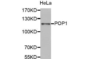 Western Blotting (WB) image for anti-Processing of Precursor 1, Ribonuclease P/MRP Subunit (S. Cerevisiae) (POP1) antibody (ABIN1876990)