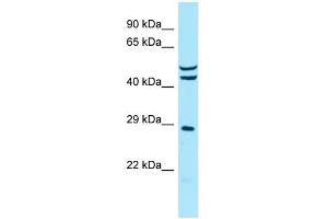 Host: Rabbit Target Name: MRPS7 Sample Type: MCF7 Whole Cell lysates Antibody Dilution: 1.