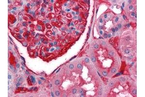 Immunohistochemical analysis of paraffin-embedded human Kidney tissues using anti-A1BG antibody (A1BG antibody)