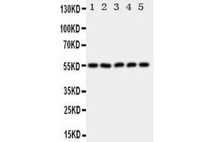 Western Blotting (WB) image for anti-Hyaluronidase-2 (HYAL2) (AA 142-157), (C-Term) antibody (ABIN3043041) (HYAL2 antibody  (C-Term))