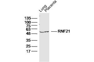 Lane 1: Mouse Lung lysates Lane 2: Mouse Placenta lysates probed with RNF21 Polyclonal Antibody, Unconjugated  at 1:300 dilution and 4˚C overnight incubation. (Protein RNF21 antibody)