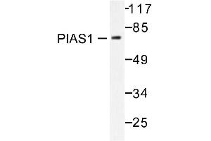 Image no. 1 for anti-Protein Inhibitor of Activated STAT, 1 (PIAS1) antibody (ABIN271951)