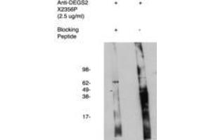 Image no. 1 for anti-Degenerative Spermatocyte Homolog 2, Lipid Desaturase (DEGS2) antibody (ABIN793718) (DEGS2 antibody)
