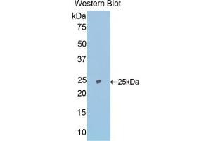 Detection of Recombinant NAGa, Mouse using Polyclonal Antibody to N-Acetylgalactosaminidase Alpha (NAGa) (NAGA antibody  (AA 18-217))