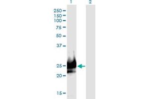 Western Blot analysis of DSCR6 expression in transfected 293T cell line by DSCR6 monoclonal antibody (M09), clone 1D1. (RIPPLY3 antibody  (AA 1-190))