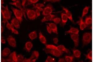 ABIN6274003 staining HepG2 by IF/ICC. (COL17A1 antibody  (N-Term))