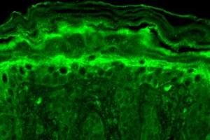 Immunohistochemistry analysis using Mouse Anti-Slo2. (KCNT1 antibody  (AA 1168-1237) (PE))