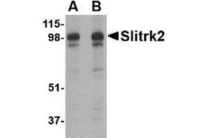Western blot analysis of Slitrk2 in rat brain tissue lysate with Slitrk2 antibody at (A) 1 and (B) 2 µg/ml. (SLITRK2 antibody  (C-Term))