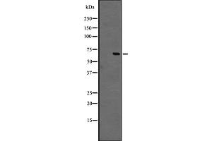 Western blot analysis of GPR44 expression in Jurkat cell lysate,The lane on the left is treated with the antigen-specific peptide. (Prostaglandin D2 Receptor 2 (PTGDR2) (Internal Region) antibody)