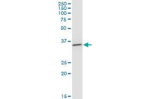 BDH1 monoclonal antibody (M03), clone 4B3. (BDH1 antibody  (AA 1-343))