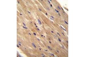 Formalin fixed, paraffin embedded Mouse heart tissue stained with RhoJ Antibody  followed by peroxidase conjugation of the secondary antibody and DAB staining. (RHOJ antibody  (Middle Region))