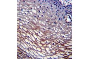 Formalin fixed, paraffin embedded human cervix tissue stained with SKA2 Antibody (N-term) followed by peroxidase conjugation of the secondary antibody and DAB staining. (FAM33A antibody  (N-Term))