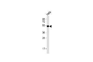 Anti-HtrA1 Antibody (N-term) at 1:1000 dilution + Hela whole cell lysate Lysates/proteins at 20 μg per lane.