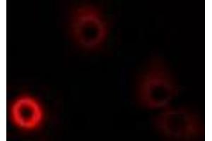 Immunofluorescent analysis of DAO staining in MCF7 cells. (D Amino Acid Oxidase antibody)