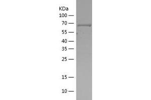 CSNK2A1/CK II alpha Protein (AA 6-344) (His-IF2DI Tag)