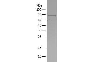 Western Blotting (WB) image for Casein Kinase 2 alpha 1 (CSNK2A1) (AA 6-344) protein (His-IF2DI Tag) (ABIN7122158) (CSNK2A1/CK II alpha Protein (AA 6-344) (His-IF2DI Tag))