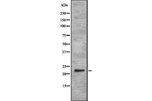 Western blot analysis of RAB35 using K562 whole cell lysates (RAB35 antibody  (Internal Region))