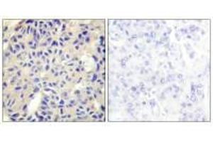 COL5A2 antibody