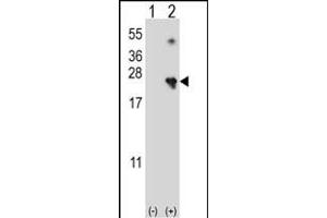 Western blot analysis of NME4 (arrow) using rabbit polyclonal NME4 Antibody (M1) (ABIN392784 and ABIN2842222). (NME4 antibody  (N-Term))