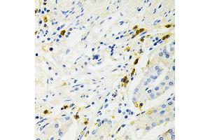 Immunohistochemistry of paraffin-embedded human stomach using NF-kB p65/RelA Antibody (ABIN3016234, ABIN3016235, ABIN3016236 and ABIN6219643) at dilution of 1:200 (40x lens). (NF-kB p65 antibody  (AA 50-180))