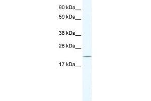 WB Suggested Anti-HTATIP2 Antibody Titration:  0. (HIV-1 Tat Interactive Protein 2, 30kDa (HTATIP2) (N-Term) antibody)