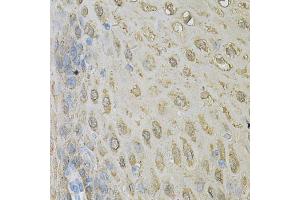 Immunohistochemistry of paraffin-embedded human esophagus using ALDH3A1 Antibody. (ALDH3A1 antibody)